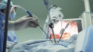 successful-thoracolaparoscopic-esophagectomy-for-esophageal-cancer--dr-pavan-kumar-c-g-thumbnail