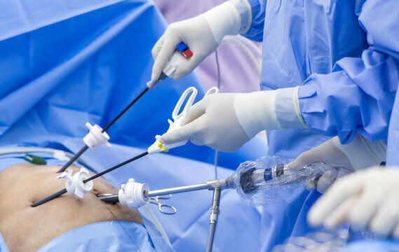 from-fear-to-happy-recovery-the-impact-of-laparoscopy-in-colon-cancer-surgery-discharged-on-day-5-after-major-surgery-image